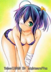 ahoge bandage bandages bikini blue_hair breasts chuunibyou_demo_koi_ga_shitai! eyepatch frilled_bikini frills green_eyes multicolored_hair nightmare77zx purple_hair short_hair side_ponytail solo swimsuit takanashi_rikka