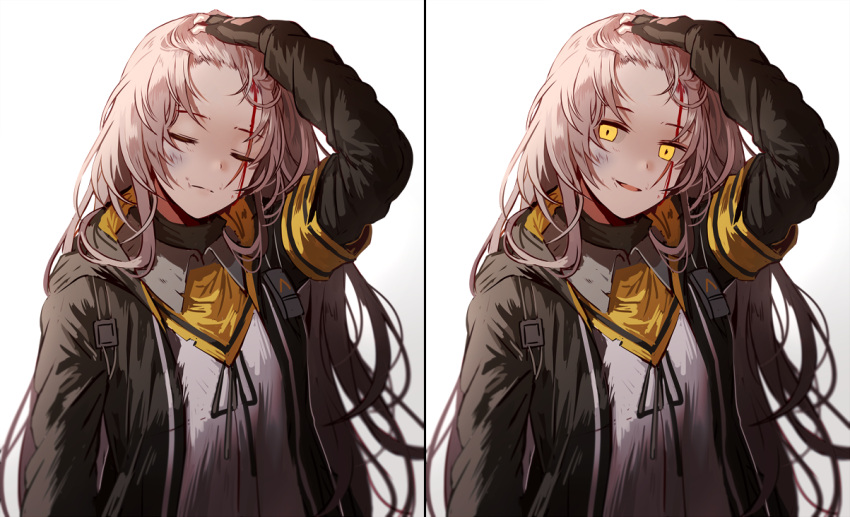1girl :d armband bangs black_jacket blood brown_hair bruise bruise_on_face closed_eyes closed_mouth commentary damaged expressionless facing_viewer fingerless_gloves girls_frontline gloves hair_ornament hand_on_own_head hood hood_down hooded_jacket injury jacket long_hair looking_at_viewer multiple_views neck_ribbon one_side_up open_clothes open_jacket open_mouth ribbon scar scar_across_eye scarf shirt sidelocks silence_girl simple_background smile solo torn_clothes ump45_(girls_frontline) upper_body white_background white_ribbon white_shirt yellow_eyes