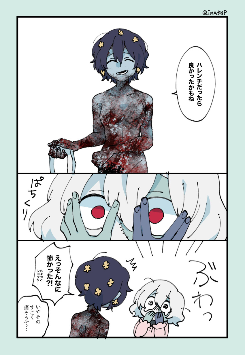 2girls absurdres bandage burn_scar comic covering_eyes covering_mouth flower hair_flower hair_ornament highres inahara konno_junko mizuno_ai multiple_girls nude pajamas scar stitches surprised tearing_up twitter_username wide-eyed zombie_land_saga