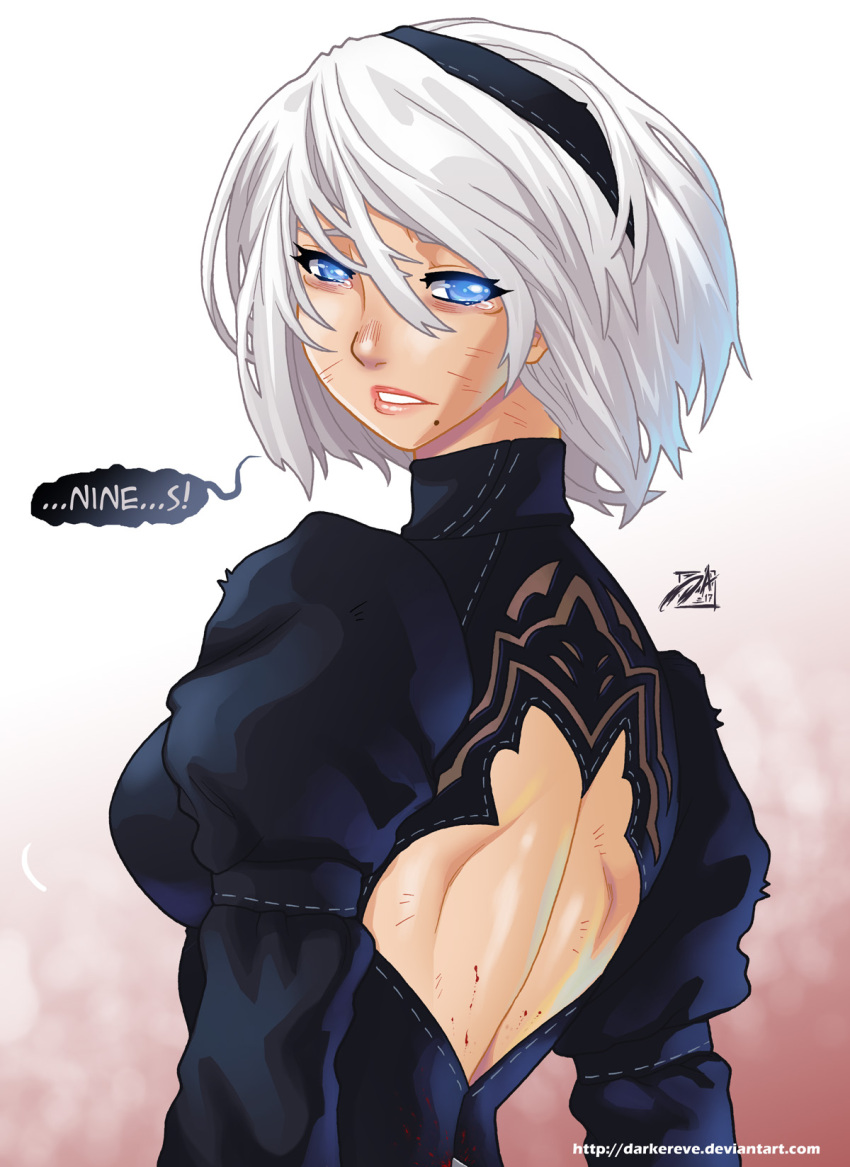 1girl back back_cutout black_dress black_hairband blood blood_splatter blue_eyes breasts bruise commentary crying crying_with_eyes_open darwin_nunez dress english_commentary english_text hairband highres injury juliet_sleeves lips long_sleeves looking_back mole mole_under_mouth nier_(series) nier_automata no_blindfold puffy_sleeves sad short_hair silver_hair solo spoilers tears watermark web_address yorha_no._2_type_b