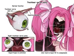 mizi (alien stage) from alien stage