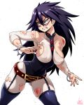  1girl ass_visible_through_thighs black_hair blood blood_on_face blue_eyes bodysuit boku_no_hero_academia breastless_clothes breasts bruise clenched_teeth covered_nipples cowboy_shot cuffs domino_mask hair_between_eyes highres injury jmg large_breasts long_hair looking_away mask midnight_(boku_no_hero_academia) mole mole_under_eye serious solo teeth torn_bodysuit torn_clothes tsurime 