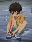  1boy bleeding blood bruise child commentary_request cuts gurio0505 highres injury male_focus original shorts solo translation_request 