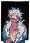  1boy artist_name bangs blue_eyes boku_no_hero_academia crazy_smile dabi_(boku_no_hero_academia) hand_on_own_chest kadeart male_focus open_mouth scar scar_on_arm scar_on_chest scar_on_face short_sleeves solo stapled stitched_arm stitched_face stitched_torso stitches todoroki_touya torn_clothes white_hair 