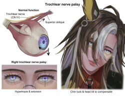  1girl anatomy animal_ears arrow_(symbol) black_hair blonde_hair blue_eyes collared_coat collared_shirt colored_inner_hair cross-eyed cross-section dream_journey_(reminder_of_dreamland)_(umamusume) dream_journey_(umamusume) english_text eye_focus eyeball eyelashes eyewear_strap glasses hair_between_eyes head_tilt horse_ears horse_girl lazy_eye long_hair looking_at_viewer meme miengplazabzab multicolored_eyes multicolored_hair organs pink_eyes red_shirt shirt simple_background solo streaked_hair trochlear_nerve_palsy_diagram_(meme) umamusume white_background white_hair white_streaks 