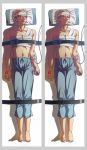  bandage bandages barefoot bed_straps blonde_hair blue_eyes blush catheter command_spell dakimakura face fate/zero fate_(series) feet gurney highres iv_tube kayneth_archibald_el-melloi male pants parody sunday31 